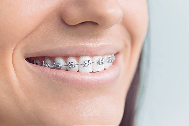 Best Traditional Braces  in Portland, ME